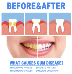 Teeth Repair & Gum Relief Gel – Hyaluronic Acid Oral Care Treatment with Aloe & Vitamin C